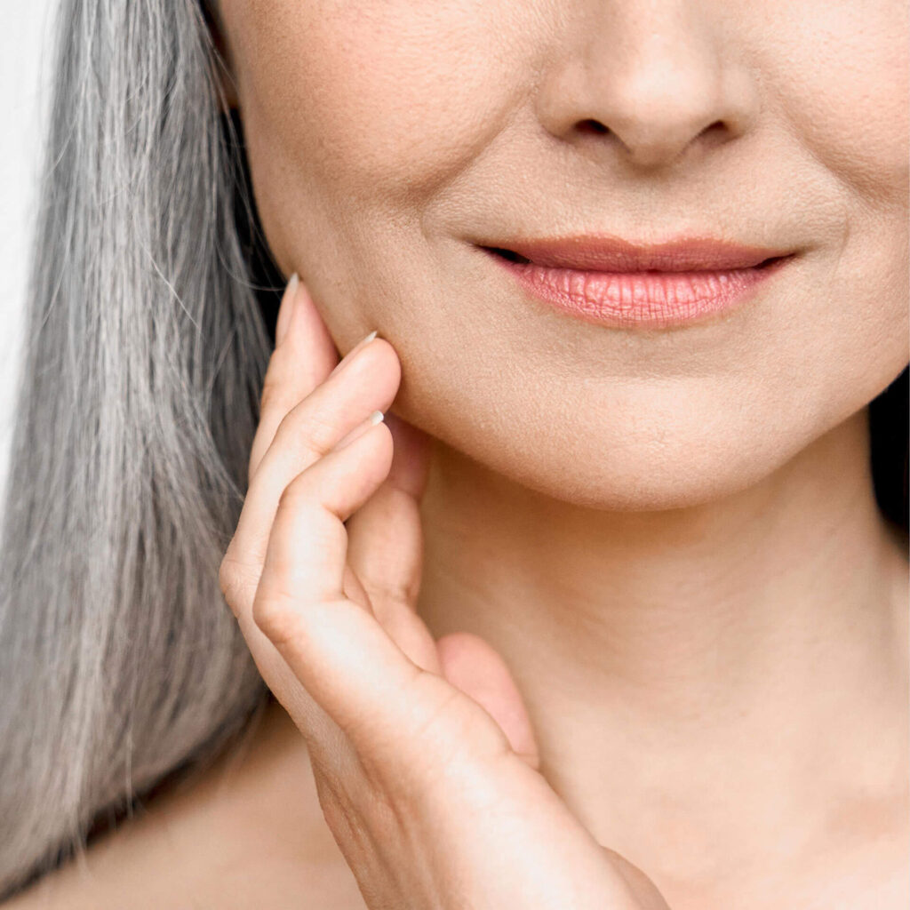 Fine lines removal Vancouver BC